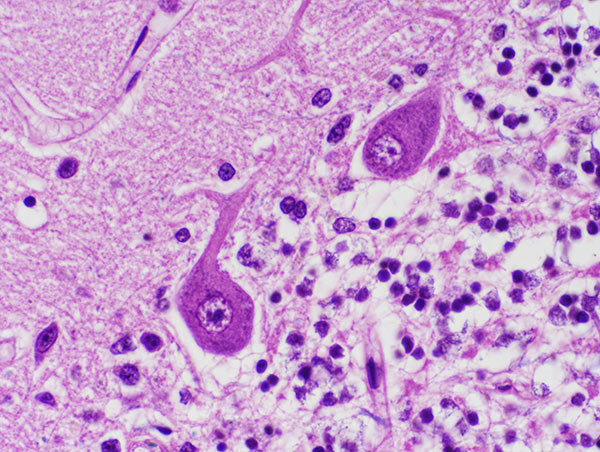 Brain cell