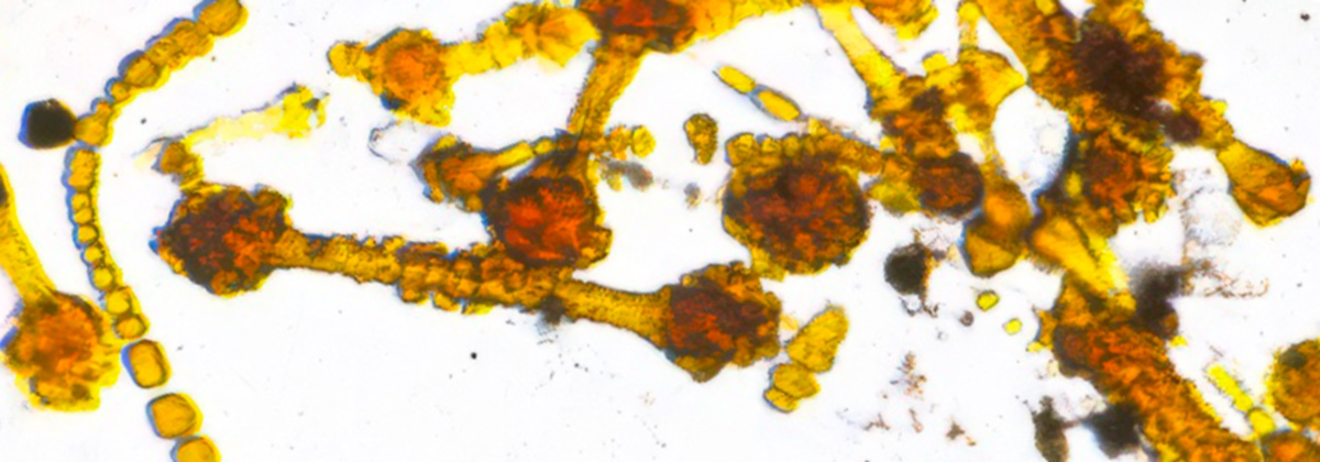 Asbestos Bodies